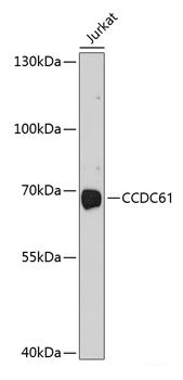 Western blot analysis of extracts from normal (control) and BCL10 knockout (KO) HeLa cells using BCL10 Polyclonal Antibody at dilution of 1:1000.