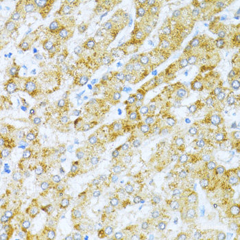 Western blot analysis of extracts of Rat liver using GRM1 Polyclonal Antibody at dilution of 1:1000.