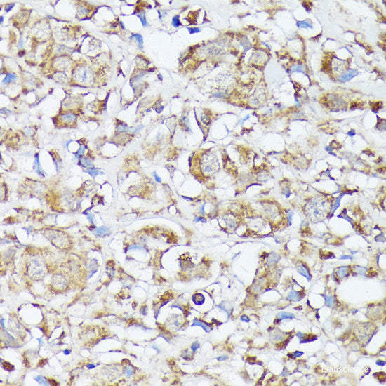 Immunohistochemistry of paraffin-embedded Human tonsil using IL6 Polyclonal Antibody at dilution of 1:100 (40x lens).