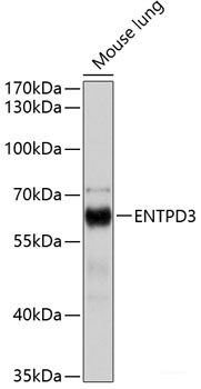 Immunofluorescence analysis of U2OS cells using MMP2 Polyclonal Antibody at dilution of 1:100. Blue: DAPI for nuclear staining.