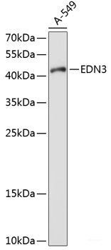 Immunohistochemistry of paraffin-embedded Mouse kidney using IKB alpha Polyclonal Antibody at dilution of 1:100 (40x lens).