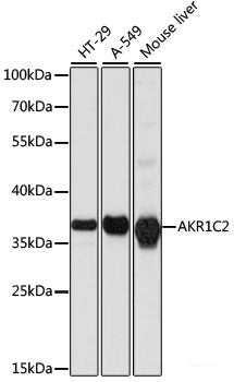 Immunofluorescence analysis of A549 cells using Parkin Polyclonal Antibody
