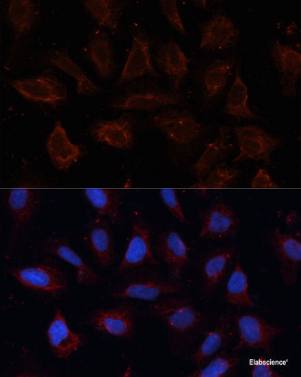 Immunohistochemistry of paraffin-embedded Human colon using FAK Polyclonal Antibody at dilution of 1:100 (40x lens).
