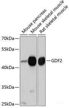 Western blot analysis of extracts of various cell lines using TNNT2 Polyclonal Antibody at dilution of 1:1000.
