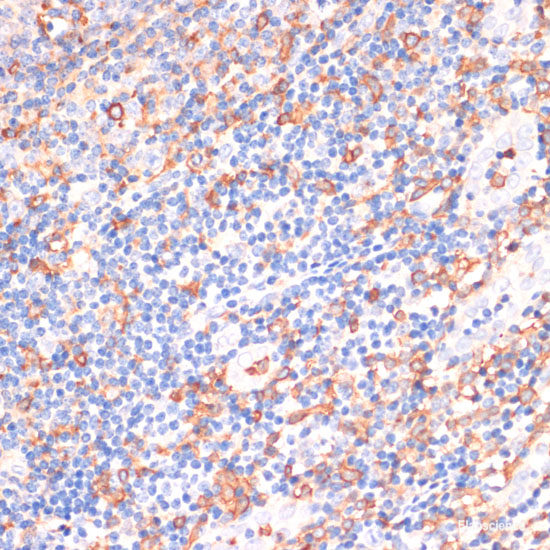 Immunohistochemistry of paraffin-embedded Human tonsil using EGFR Polyclonal Antibody at dilution of 1:150 (40x lens).