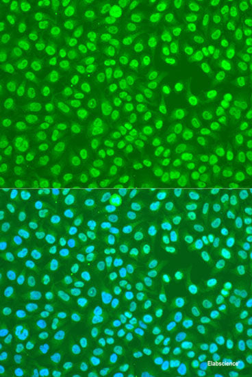 Western blot analysis of extracts of K-562 cells using mTOR Polyclonal Antibody at dilution of 1:1000.