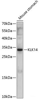 Immunohistochemistry of paraffin-embedded Human stomach using Lyn Polyclonal Antibody at dilution of 1:100 (40x lens).