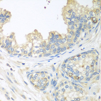 Immunofluorescence analysis of HeLa cells using Ki67 Polyclonal Antibody