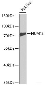 Immunofluorescence analysis of Y79 cells using Rb Polyclonal Antibody at dilution of 1:100 (40x lens). Blue: DAPI for nuclear staining.