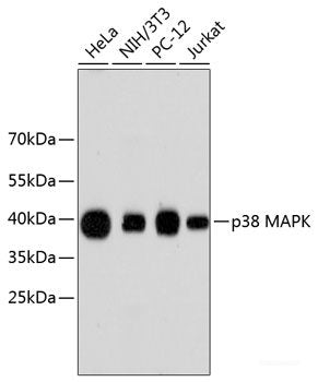 Immunohistochemistry of paraffin-embedded Rat ovary using MAP1LC3A Polyclonal Antibody at dilution of 1:100 (40x lens).