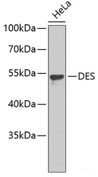 Western blot analysis of extracts of various cell lines using TRADD Polyclonal Antibody at dilution of 1:1000.