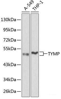 Western blot analysis of extracts from normal (control) and SQSTM1 / p62 knockout (KO) 293T cells using SQSTM1 / p62 Polyclonal Antibody at dilution of 1:1000.