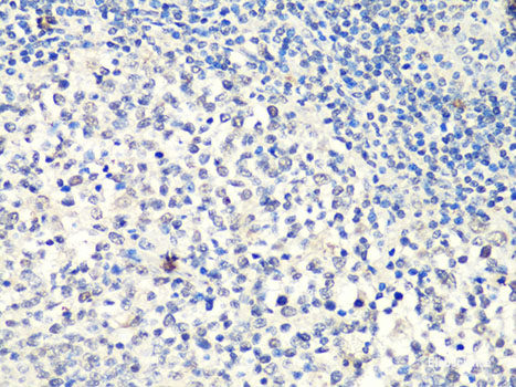Immunofluorescence analysis of C6 cells using SOX2 Polyclonal Antibody at dilution of 1:100 (40x lens). Blue: DAPI for nuclear staining.