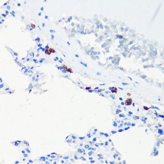 Western blot analysis of extracts of various cell lines using CXCR3 Polyclonal Antibody at dilution of 1:3000.