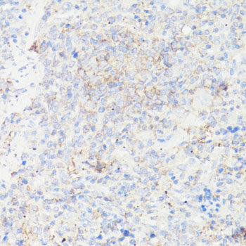 Immunofluorescence analysis of NIH/3T3 cells using DNAJA1 Polyclonal Antibody at dilution of 1:100. Blue: DAPI for nuclear staining.