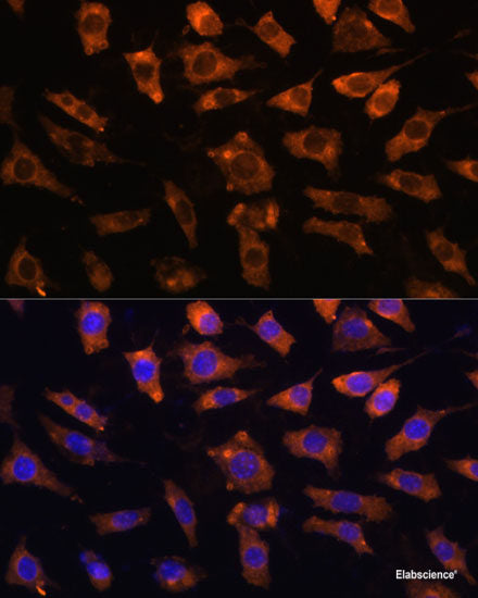 Immunofluorescence analysis of U-251 MG cells using FABP7 Polyclonal Antibody at dilution of 1:100. Blue: DAPI for nuclear staining.