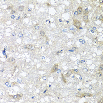Western blot analysis of extracts of Mouse brain using CALM3 Polyclonal Antibody.