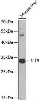 Immunofluorescence analysis of C6 cells using LAMTOR1 Polyclonal Antibody at dilution of 1:100 (40x lens). Blue: DAPI for nuclear staining.