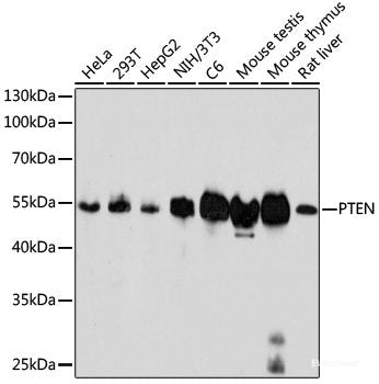 Immunohistochemistry of paraffin-embedded Human esophagus using NEDD8 Polyclonal Antibody at dilution of 1:100 (40x lens).