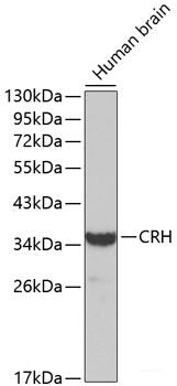 Western blot analysis of extracts of various cell lines using SOX30 Polyclonal Antibody at dilution of 1:1000.