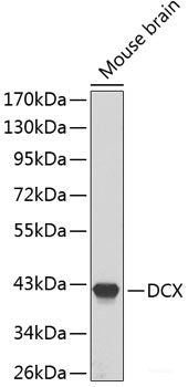 Western blot analysis of extracts of various cell lines using HLA-DRA Polyclonal Antibody at dilution of 1:1000.