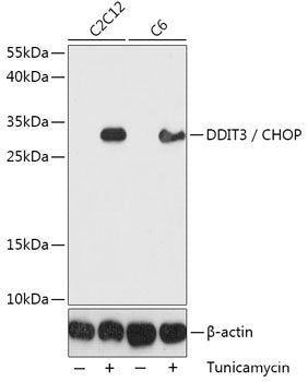 Immunohistochemistry of paraffin-embedded Human liver cancer using TGFBR2 Polyclonal Antibody at dilution of 1:100 (40x lens).