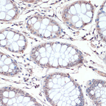 Immunohistochemistry of paraffin-embedded Human kidney using GGA2 Polyclonal Antibody at dilution of 1:200 (40x lens).