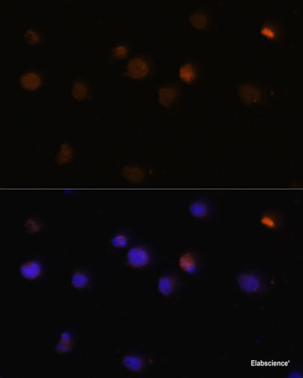 Western blot analysis of extracts of various cell lines using MMP1 Polyclonal Antibody at dilution of 1:1000.