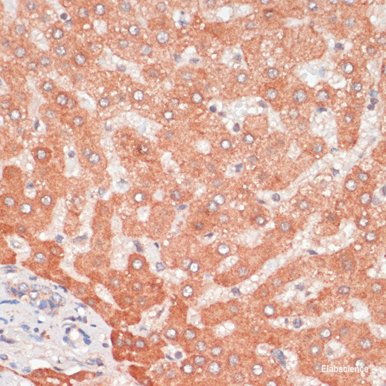 Immunohistochemistry of paraffin-embedded Rat intestine using HGF Polyclonal Antibody at dilution of 1:100 (40x lens).