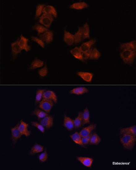 Western blot analysis of extracts of various cell lines using FCGR1A Polyclonal Antibody at dilution of 1:1000.