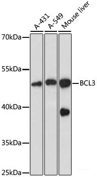 Western blot analysis of extracts of various cell lines using MYH10 Polyclonal Antibody at dilution of 1:3000.