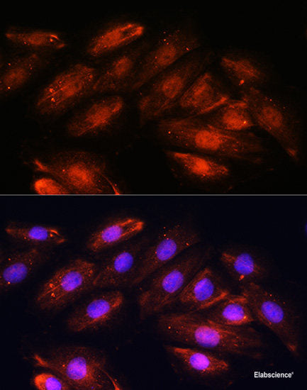 Western blot analysis of extracts of various cell lines using RANBP9 Polyclonal Antibody at dilution of 1:3000.