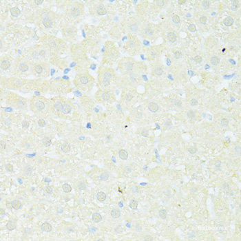 Western blot analysis of extracts of various cell lines using WDR1 Polyclonal Antibody at dilution of 1:3000.