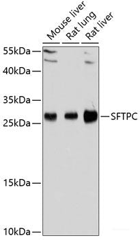 Western blot analysis of extracts of various cell lines using AGMAT Polyclonal Antibody at dilution of 1:1000.