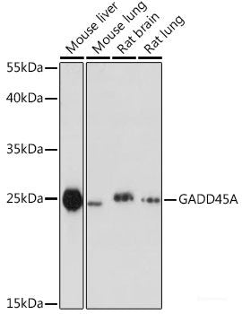 Western blot analysis of extracts of various cell lines using ATL3 Polyclonal Antibody at dilution of 1:1000.