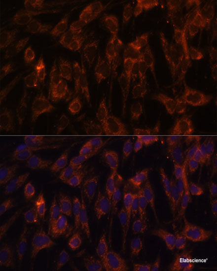 Western blot analysis of extracts of HepG2 cells using KCNK4 Polyclonal Antibody at dilution of 1:1000.