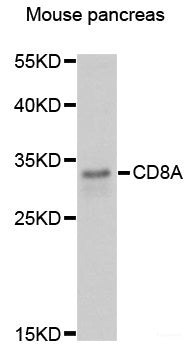 Western blot analysis of extracts of various cell lines using AKR7A2 Polyclonal Antibody at dilution of 1:1000.