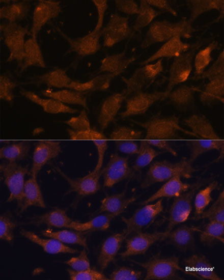 Western blot analysis of extracts of various cell lines using SLC12A7 Polyclonal Antibody at dilution of 1:1000.