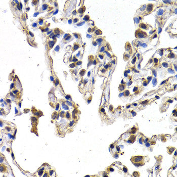 Immunofluorescence analysis of HeLa cells using BST2 Polyclonal Antibody at dilution of 1:100. Blue: DAPI for nuclear staining.