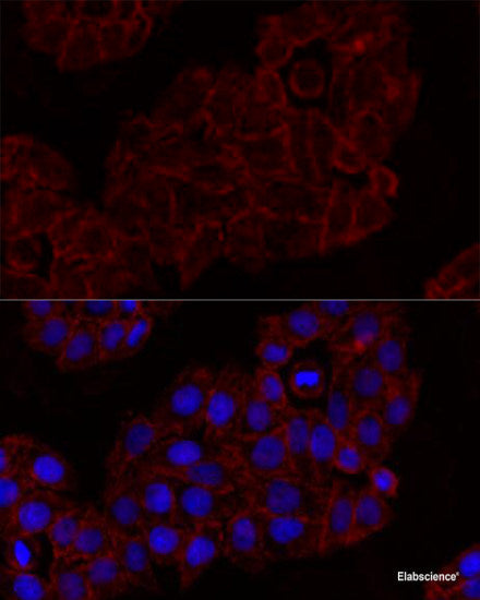 Immunohistochemistry of paraffin-embedded Rat brain using NTS Polyclonal Antibody at dilution of 1:100 (40x lens).