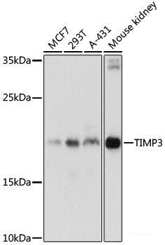 Western blot analysis of extracts of various cell lines using STAT5B Polyclonal Antibody at dilution of 1:3000.