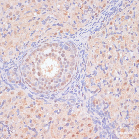 Immunohistochemistry of paraffin-embedded Human placenta using GPR78 Polyclonal Antibody at dilution of 1:100 (40x lens).