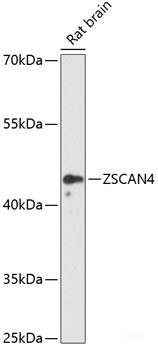 Western blot analysis of extracts of various cell lines using ANXA3 Polyclonal Antibody at dilution of 1:3000.