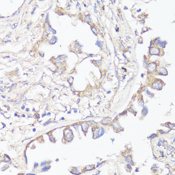 Immunofluorescence analysis of NIH/3T3 cells using GPC3 Polyclonal Antibody at dilution of 1:100. Blue: DAPI for nuclear staining.