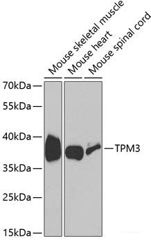 Immunofluorescence analysis of A549 cells using FAS Polyclonal Antibody