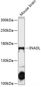 Western blot analysis of extracts of Mouse heart using C1 Inactivator Polyclonal Antibody at dilution of 1:1000.