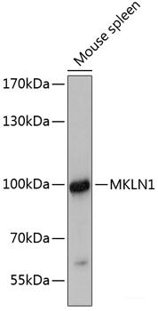 Immunohistochemistry of paraffin-embedded Human lung using IFNG Polyclonal Antibody at dilution of 1:100 (40x lens).