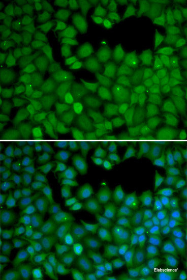 Immunohistochemistry of paraffin-embedded Rat brain using OGDH Polyclonal Antibody at dilution of 1:100 (40x lens).