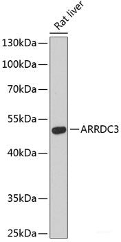 Western blot analysis of extracts of various cell lines using SERPINA1 Polyclonal Antibody at dilution of 1:1000.