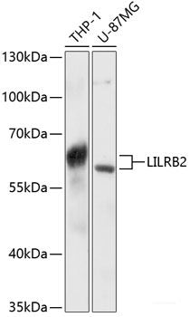 Immunohistochemistry of paraffin-embedded Rat brain using PSMD13 Polyclonal Antibody at dilution of 1:100 (40x lens).